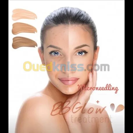 Microneedling et BBglow 