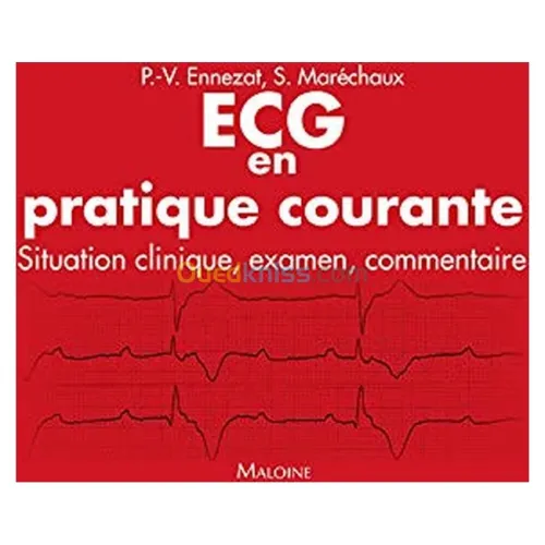 ECG en pratique courante