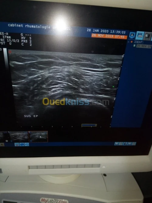 Echographe esaote mylab 70 Xvision