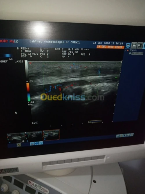 Echographe esaote mylab 70 Xvision