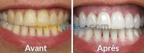 Blanchiment 08h30 à 00h00