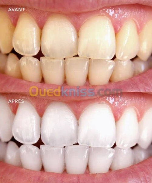 Blanchiment 08h30 à 00h00