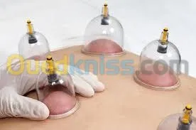 Hijama Médicale 
