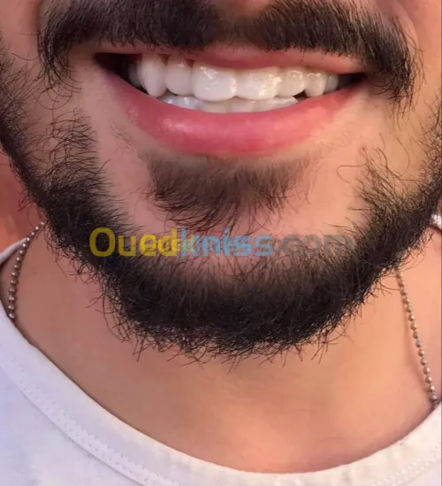 Snap on smaile