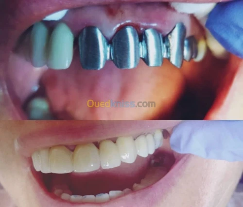 Prise Rendez-vous par téléphone 