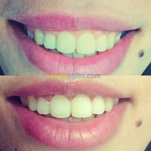 Urgences dentaires 7jours/7