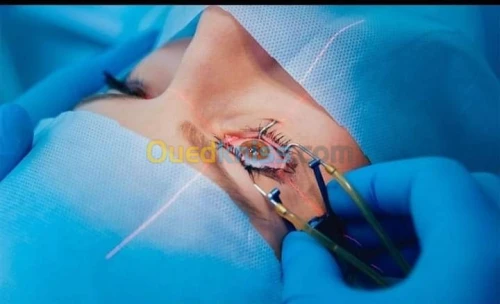 Implants pour chirurgie de cataracte 
