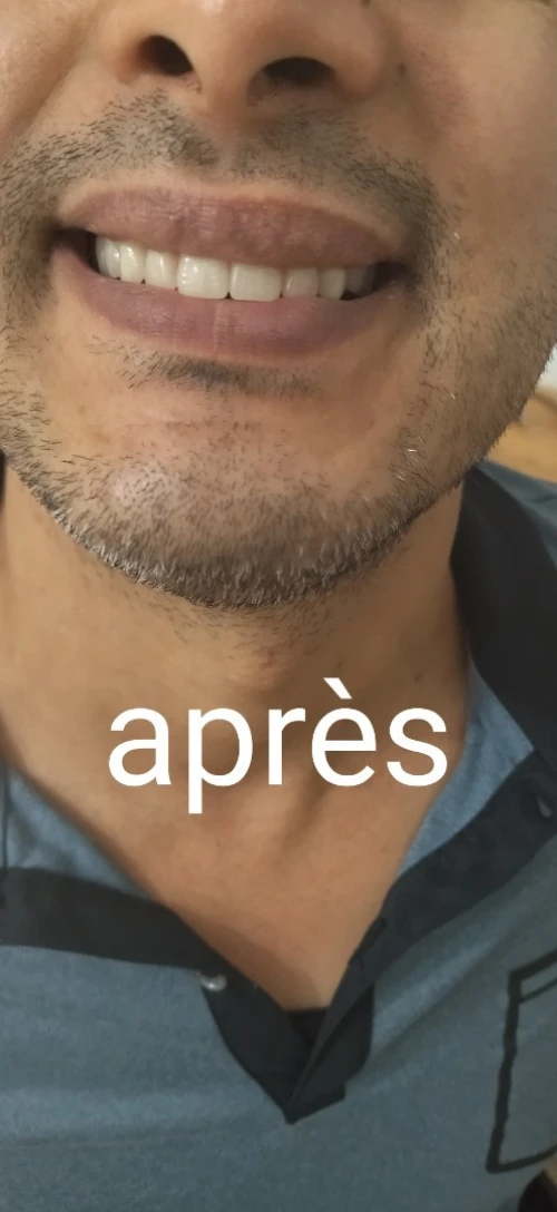 Prothésiste dentaire