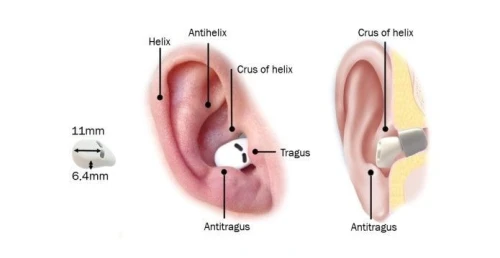 QuietON 3 SLEEP EARBUDS LES MEILLEURS ECOUTEURS POUR DORMIR 