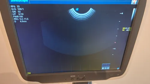 Echographe