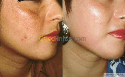 Medecine Esthétique et Accupuncture 