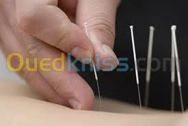 Medecine Esthétique et Accupuncture 