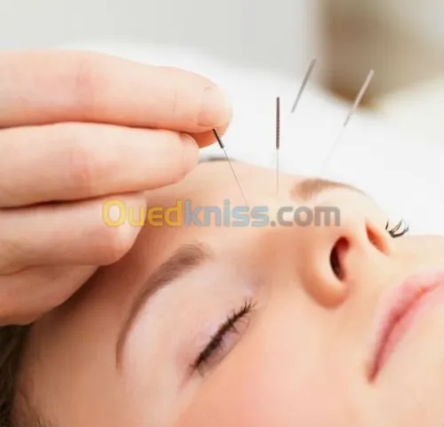 Medecine Esthétique et Accupuncture 