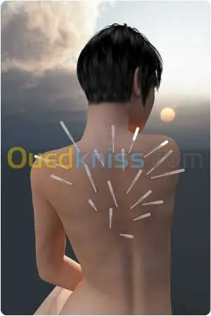 Medecine Esthétique et Accupuncture 