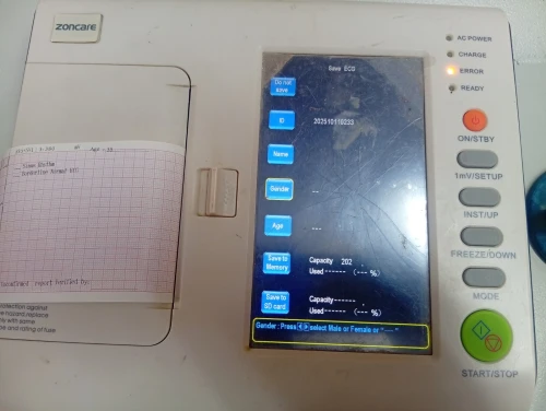 Ecg