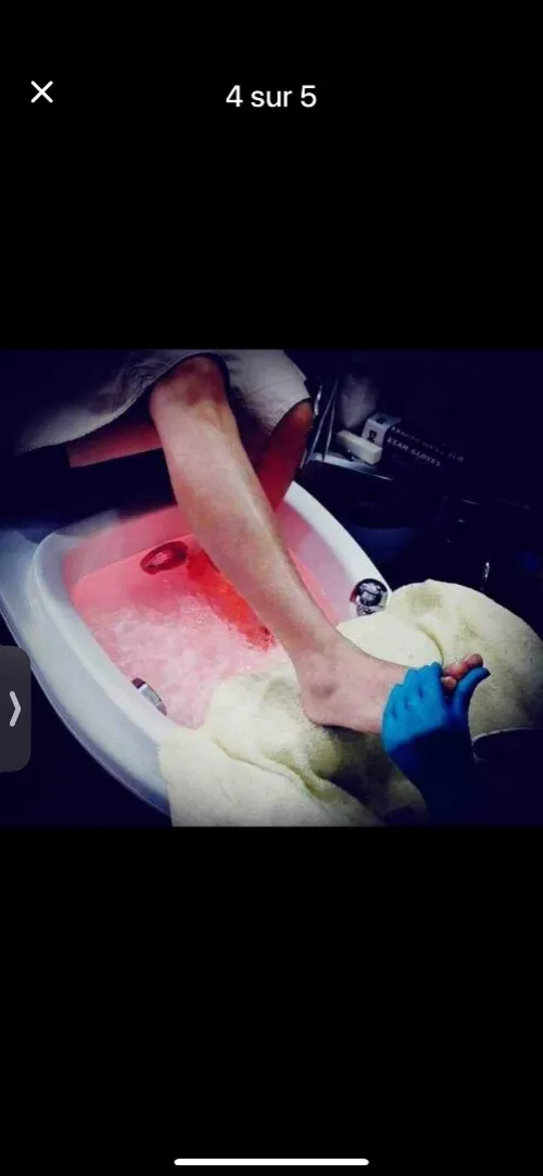 Pedispa