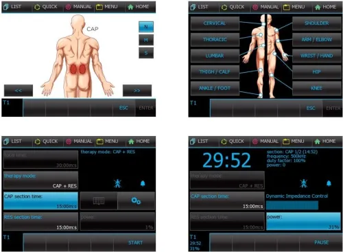 Materiel de physiothérapie professionnel kiné