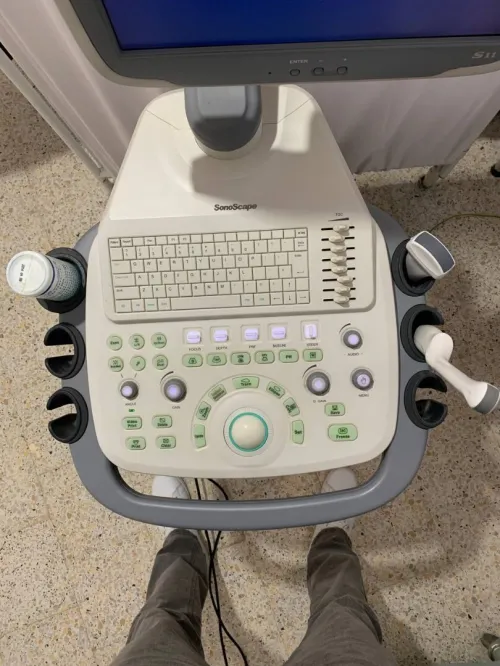 Échographe SonoScape S11 à vendre