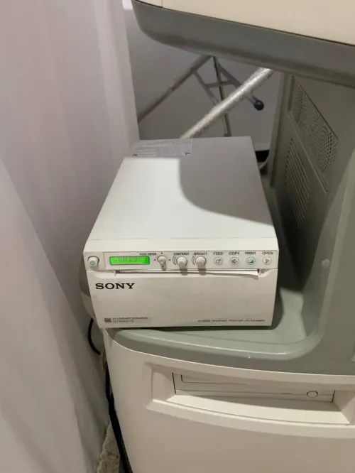 Échographe SonoScape S11 à vendre