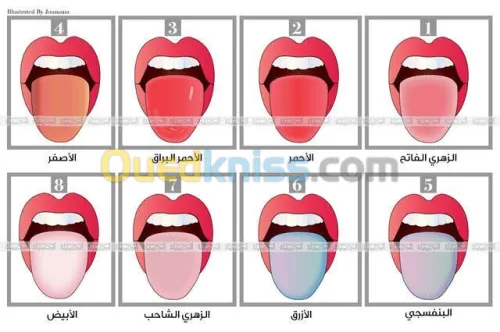 Soins generaux