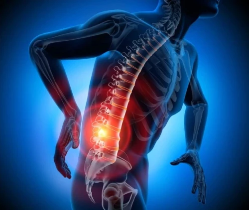 Table inversion/hernis discal
