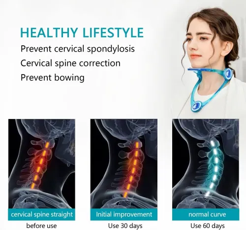 Support Cervical Ajustable  Orthèse pour Cou Enfants & Adultes
