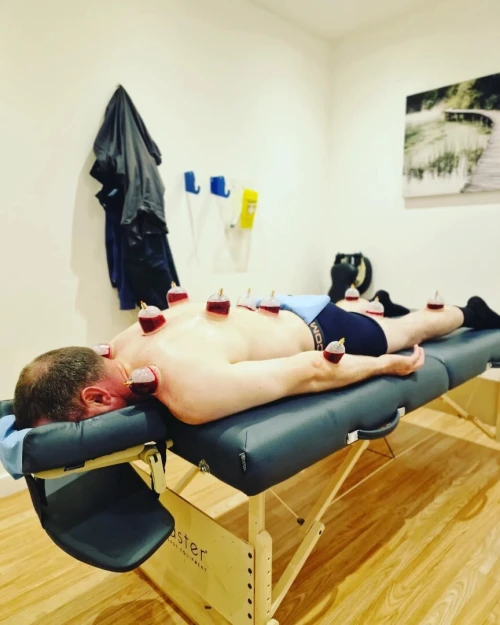 العلاج بالحجامة والطب الصيني