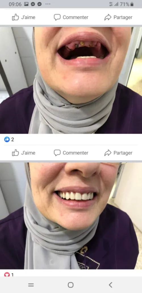 Prothésiste dentaire