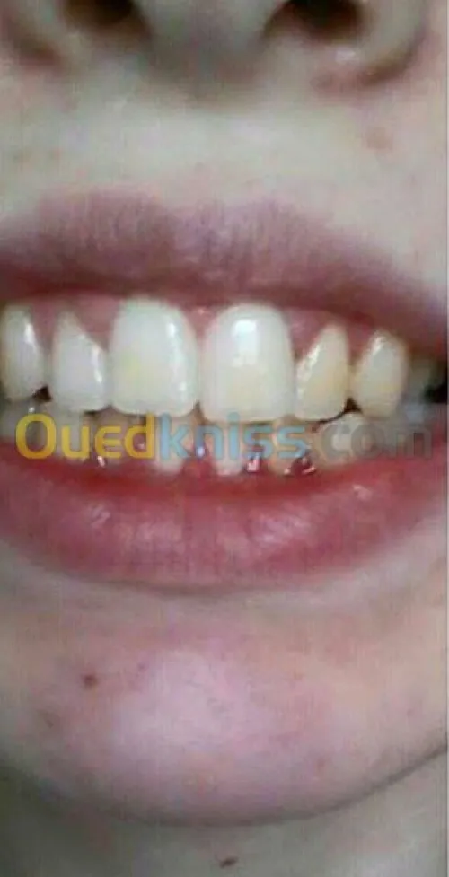 Esthétique faciale pour femmes 