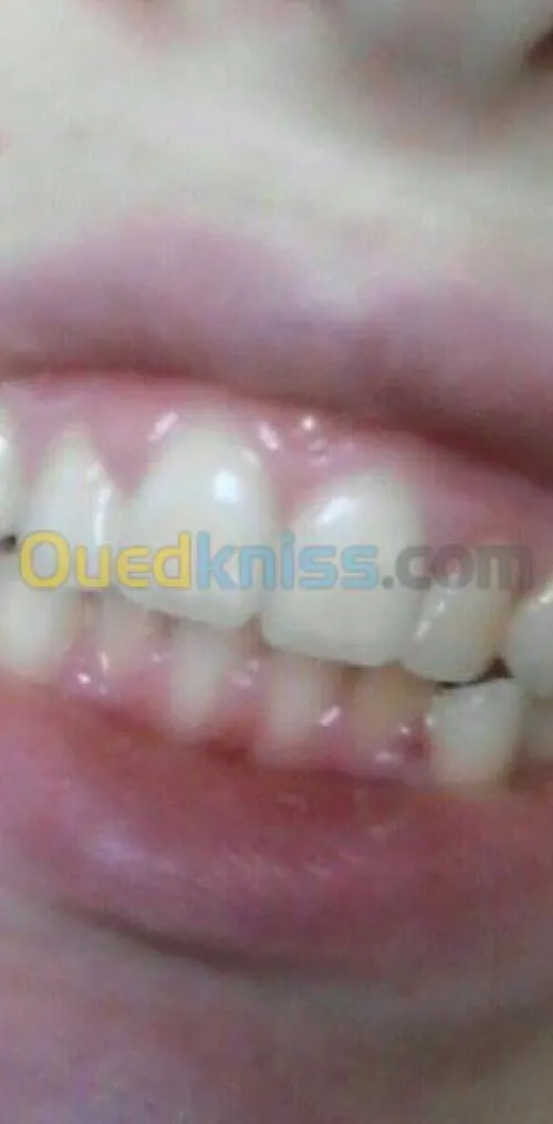 Esthétique faciale pour femmes 