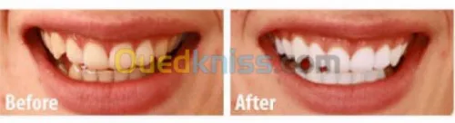 Esthétique faciale pour femmes 