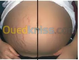 Esthétique faciale pour femmes 