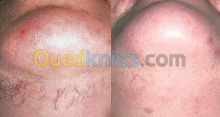 Esthétique faciale pour femmes 