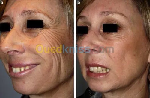 Esthétique faciale pour femmes 