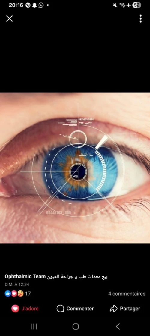 Implant pliable oculaire 