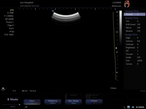 Échographe Portable XIANFENG E30 Doppler Couleur  Avec deux sondes (linéaire + convexe)