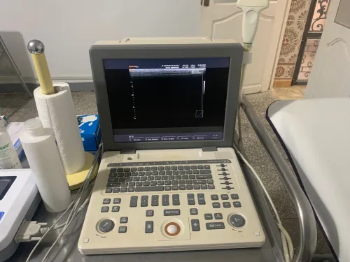 ECHOGRAPHE