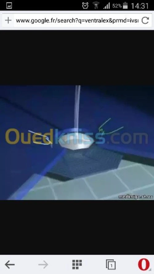 plaque hernie biface