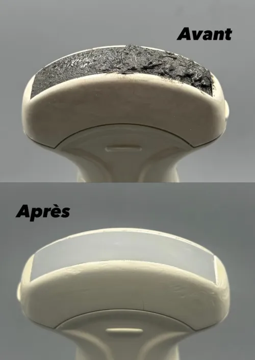 REPARATION SONDE