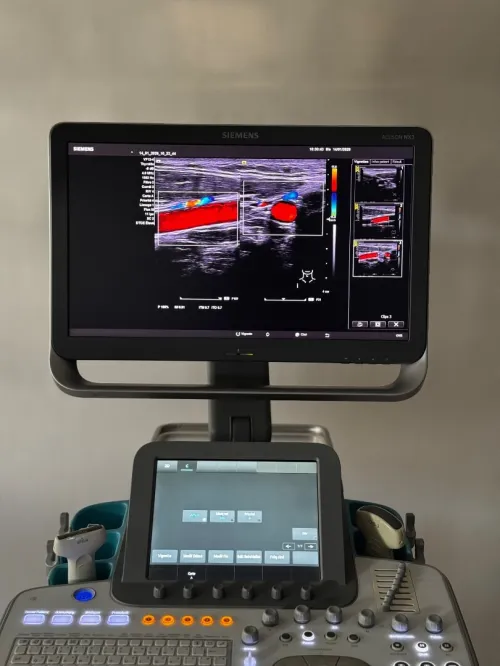 ECHOGRAPHE SIEMENS ACUSON NX3