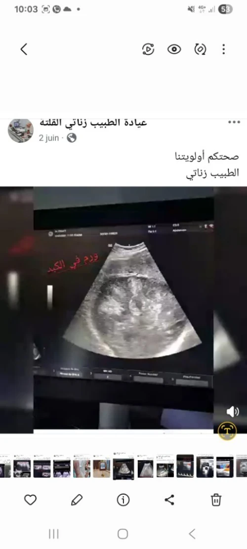 VERSANA ESSENTIAL 