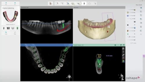 3shape Dental System 2022 + 3Shape Unite 2022 + 3shapeOrtho System 2022 + 3Shape Implant Studio 22 