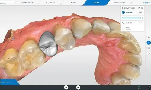 CEREC SW 5.2 Dentsply Sirona 2022