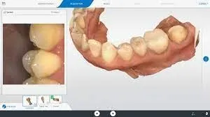 CEREC SW 5.2 Dentsply Sirona 2022