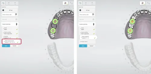 3shape Dental System 2022 + 3Shape Unite 2022 + 3shapeOrtho System 2022 + 3Shape Implant Studio 22 