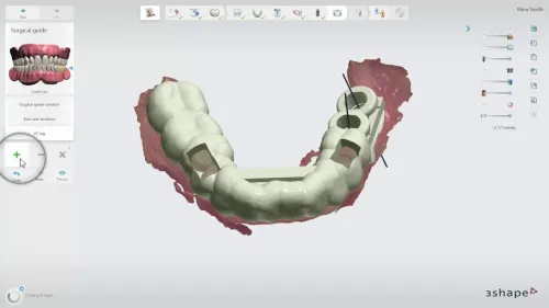 3shape Dental System 2022 + 3Shape Unite 2022 + 3shapeOrtho System 2022 + 3Shape Implant Studio 22 