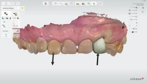 3shape Dental System 2022 + 3Shape Unite 2022 + 3shapeOrtho System 2022 + 3Shape Implant Studio 22 