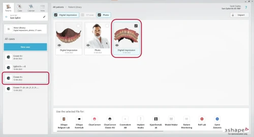 3shape Dental System 2022 + 3Shape Unite 2022 + 3shapeOrtho System 2022 + 3Shape Implant Studio 22 
