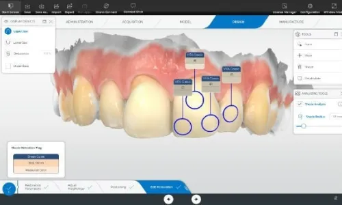CEREC SW 5.2 Dentsply Sirona 2022