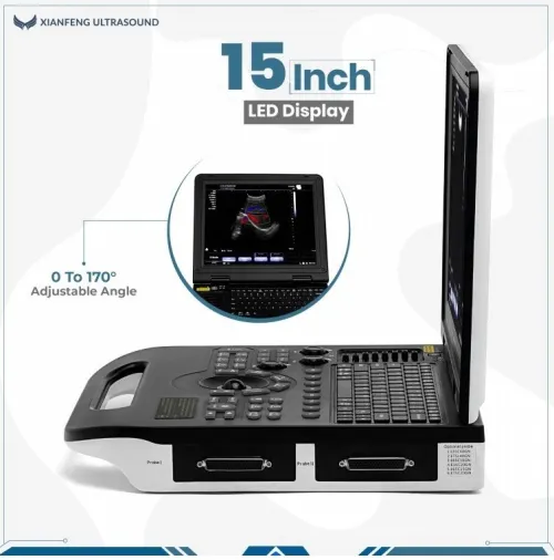 Le plus fiable , le plus rentable l'ECHOGRAPHIE PORTABLE Doppler Couleur XIANFENG E30 